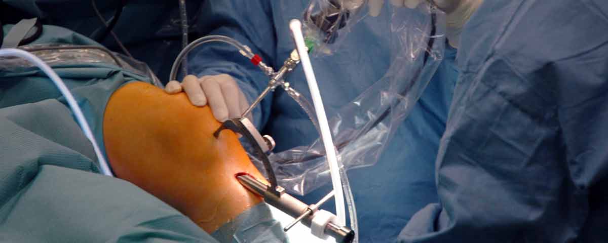Bild von Minimalinvasive Operationen von Orthopädie Dormagen